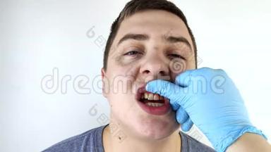 <strong>牙龈出血</strong>和炎症闭合.. 牙医检查过的人。 <strong>牙龈</strong>炎的诊断